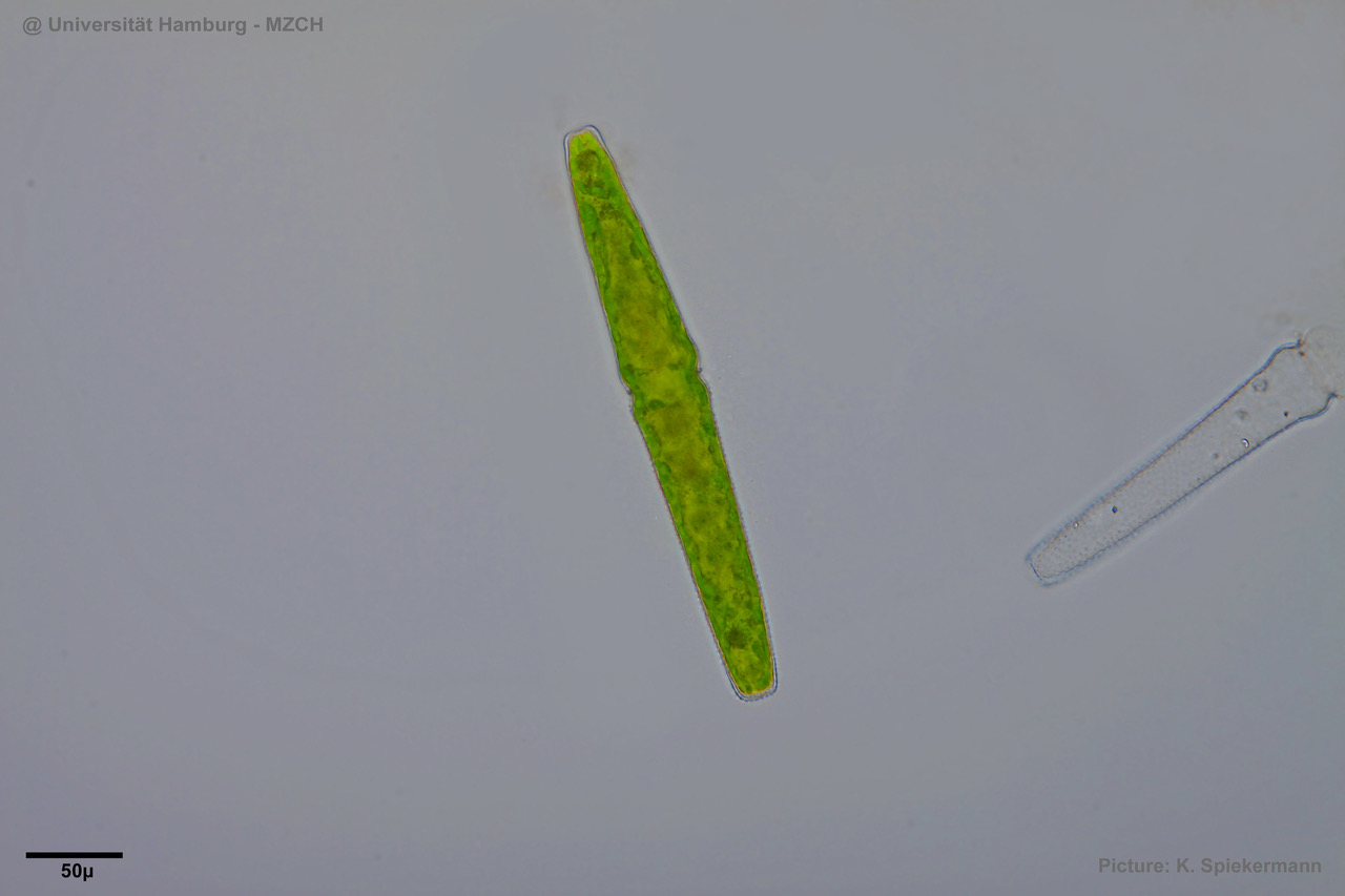 36_Pleurotaenium trabecula1_KKS.jpeg